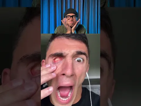Try Not To Laugh Challenge 1327 🤣