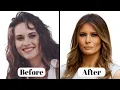 Melania Trump NEW LOOK Plastic Surgery Analysis