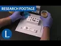 Novel lipoarabinomannan point-of-care tuberculosis test for people with HIV