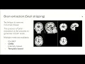 8 0 - MRI brain extraction with Python and CNNs