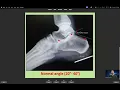 Emergency Medicine EOR Review Anki Speed Run