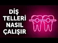 Download Lagu Diş Telleri Nasıl Çalışır (Ve Bu Süreç Neden O Kadar Yavaştır)