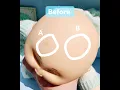 Part 1 Treating Pox on Bald CPKS