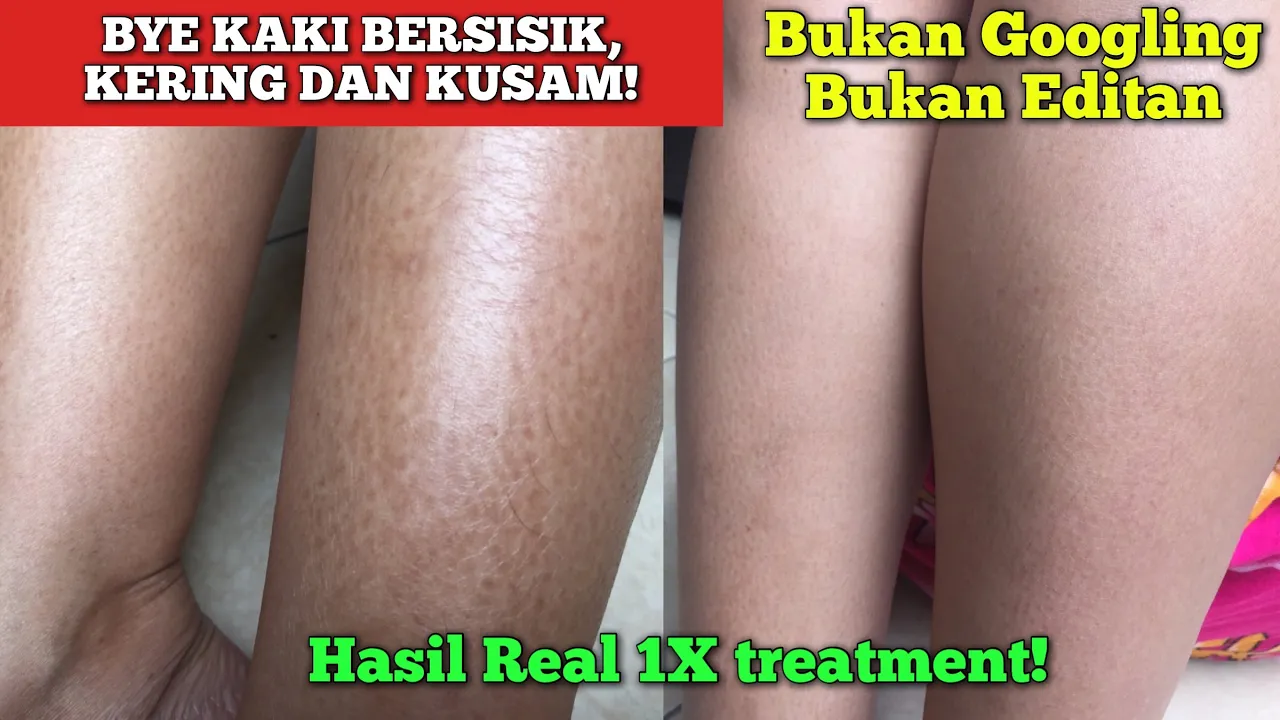 Assalamualaikum guys selamat menjalankan ibadah puasa btw walaupun kita puasa muka kita harus ttp se. 