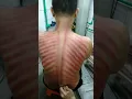 Trik cara kerokan yang benar di jamin anggin hilang #ragil #shortsvideo #viral