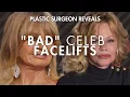 What went wrong with Goldie Hawn and Melanie Griffith s Facelifts