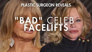 What went wrong with Goldie Hawn and Melanie Griffith s Facelifts