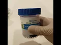 ScreenClear 9 panel urine drug test with adulterants