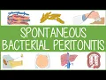 Spontaneous Bacterial Peritonitis Visually Explained