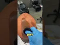 Elite Skin Head Shave Treatment