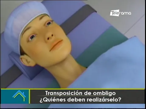 Estética al Día: Transposición de ombligo ¿Quiénes deben realizárselo?
