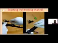 STERILIZATION OF FLEXIBLE SCOPES BY DR MANAS BABU
