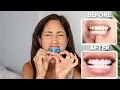 I tried Snap-On VENEERS friends and family REACTIONS
