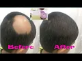 DIY Onion Juice For Hair Control