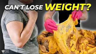 This Is Why You Can’t Lose Weight