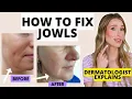 How to Fix Jowls Dermatologist Explains How to Prevent Get Rid of Jowls Dr Sam Ellis