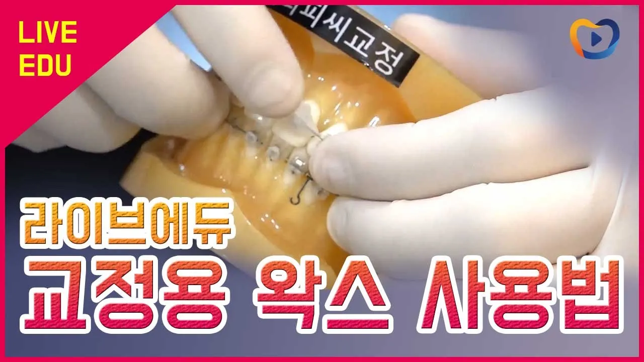[라이브에듀] 교정용 왁스 사용법