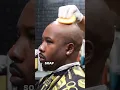 Bald head shave treatment to prevent irritation NO RAZOR BUMPS