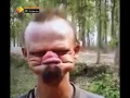 Funny Man With No Teeth