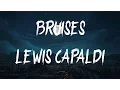 Lewis Capaldi - Bruises
