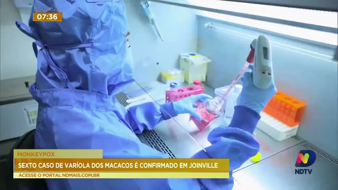 Joinville registra o 6º caso de varíola dos macacos na cidade