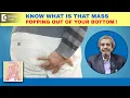 Lump or mass popping out of Hemorrhoid Polyp Cancer -Dr Rajasekhar M R Doctors Circle