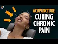 Acupuncture for Pain Relief Does it Really Work