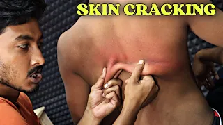 Best Skin Cracking | Deep Tissue Body Massage | Neck, Spine Cracking | ASMR