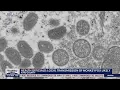 Health s Local transmission of monkeypox is likely in King County FOX 13 Seattle