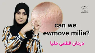                      دندنها
