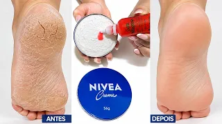 DESCOBRI o segredo para acabar com PÉ rachado e deixar Lisos e sem calos