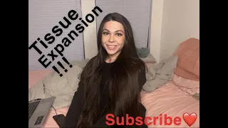 breast tissue expansion mtf pt 3 thee lady king 