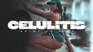 Seidy La Nina - CELULITIS