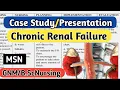 CASE STUDY PRESENTATION Chronic Renal Failure