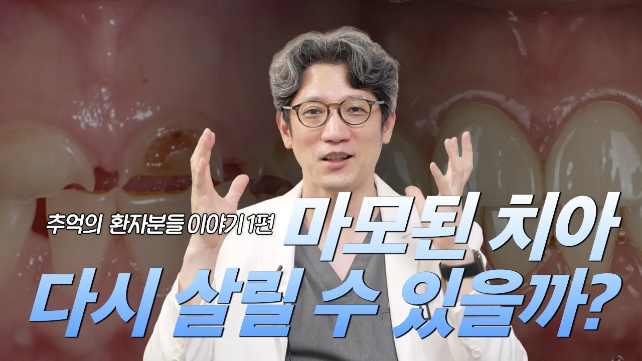 마모된 치아 다시 살릴수 있을까?