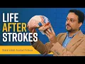 New Research Could Change Life After Stroke