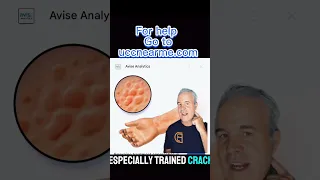 Arm itching that is driving you mad brachioradial pruritus doctor Sarasota And Venice