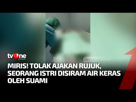 Kronologis Seorang Istri yang Disiram Air Keras oleh sang Suami, Apa Motifnya?
