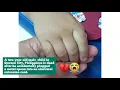 Download Lagu 2-year old boy dies after accidentally plugging a spoon into an extension cord