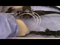 Endoscopy Technician - Using a Channel Cleaning Brush Part 2 AIMS Education