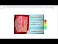 Fuzzy Scanpath Demo