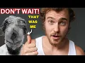 The 4 Balding Stages WHAT TO DO BEFORE IT S TOO LATE ultimate guide