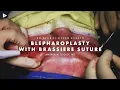 Download Lagu Bilateral Upper Eyelid Blepharoplasty with Brassiere Suture by Andrea Tooley, MD | Preview