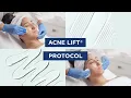 IMAGE Skincare ACNE LIFT PROTOCOL INSTRUCTIONAL