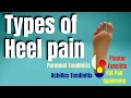 Types of Heel Pain San Diego Sports Chiropractic
