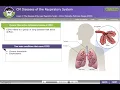 HCGTV Webinar Snippet - ICD-10-CM Coding for Chronic Obstructive Pulmonary Disease COPD