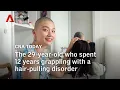 The 29-year-old who spent 12 years grappling with a hair-pulling disorder