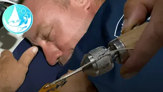 Does he need stitches? Accidents happen Episode 265 | Sailing Catalpa