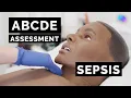 Lagu ABCDE Assessment | Sepsis | Emergency Simulation Scenario | OSCE Guide | UKMLA | CPSA | PLAB 2