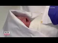 Baby Born 117 Days After Mother Is Declared Brain-Dead